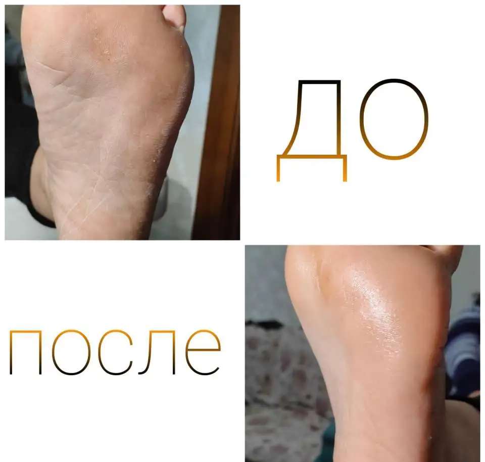 Маникюр, Смарт педикюр, наращивание ногтей